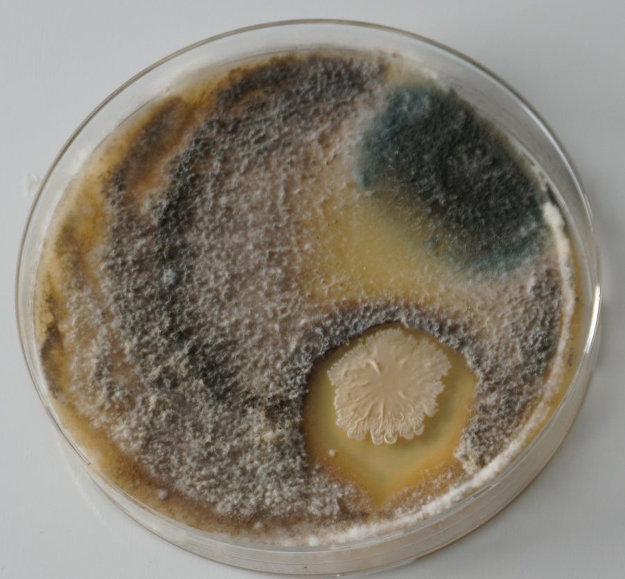 A public-restroom sample cultured — heavy mold and bacterial growth across the dish